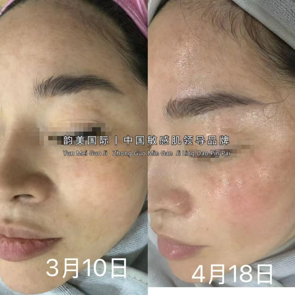 𝒀𝑼𝑵 𝑴𝑬𝑰效果篇-朋友圈文案论坛-朋友圈文案-云上韵美