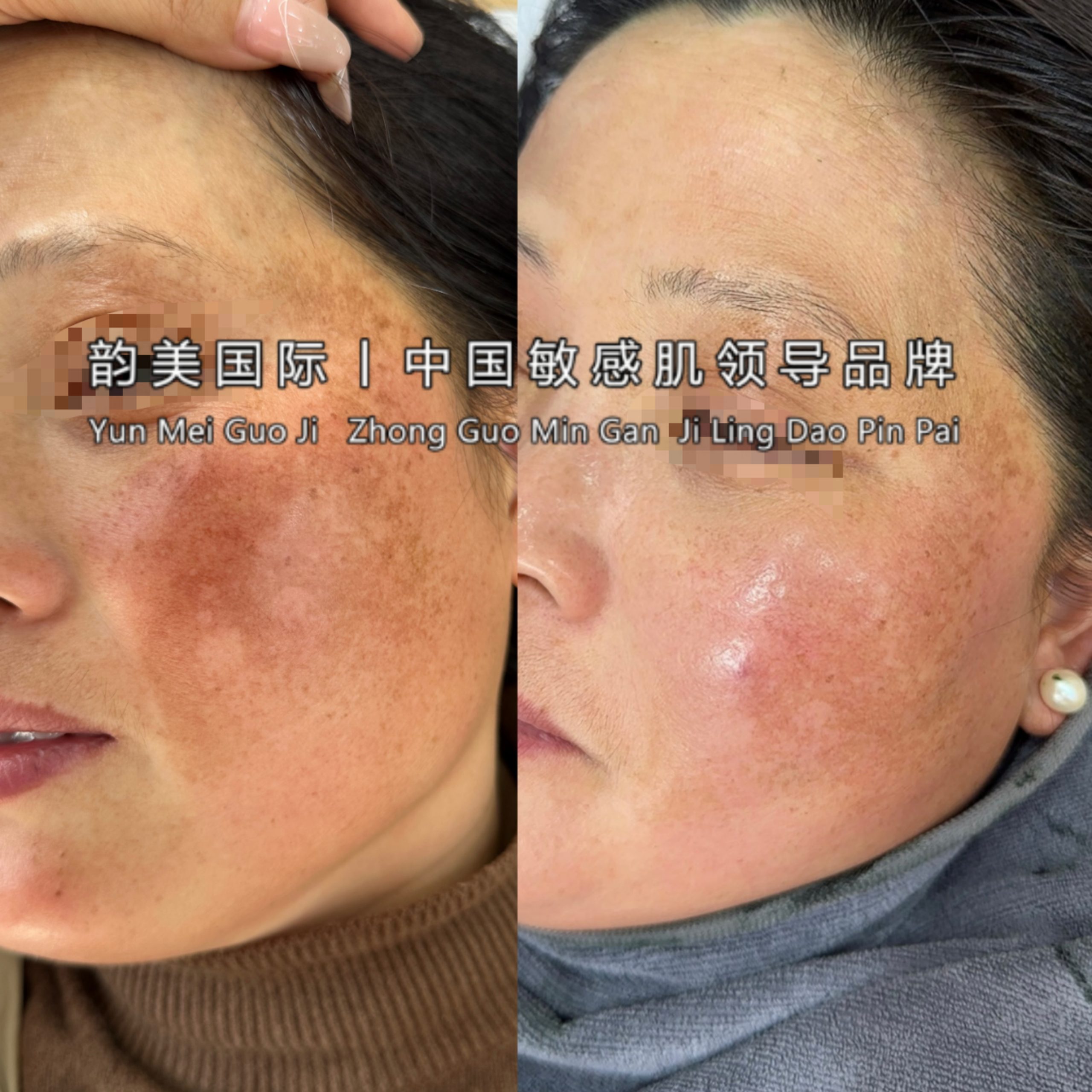 𝒀𝑼𝑵 𝑴𝑬𝑰效果篇-朋友圈文案论坛-朋友圈文案-云上韵美