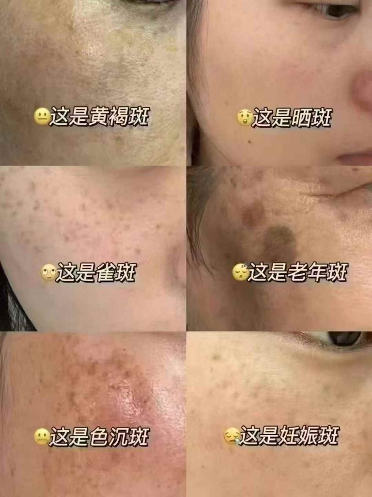 ⭕️正确辨别你的色素！-朋友圈文案论坛-朋友圈文案-云上韵美