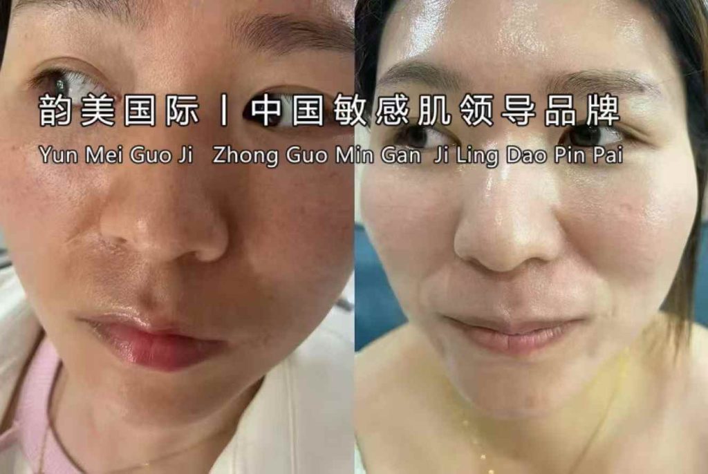 📍袪斑的意义
干掉一个曾经的自己
焕颜新生惊艳一个世界
女人最高的炫富莫过于年龄成谜皮肤无敌。-朋友圈文案论坛-朋友圈文案-云上韵美