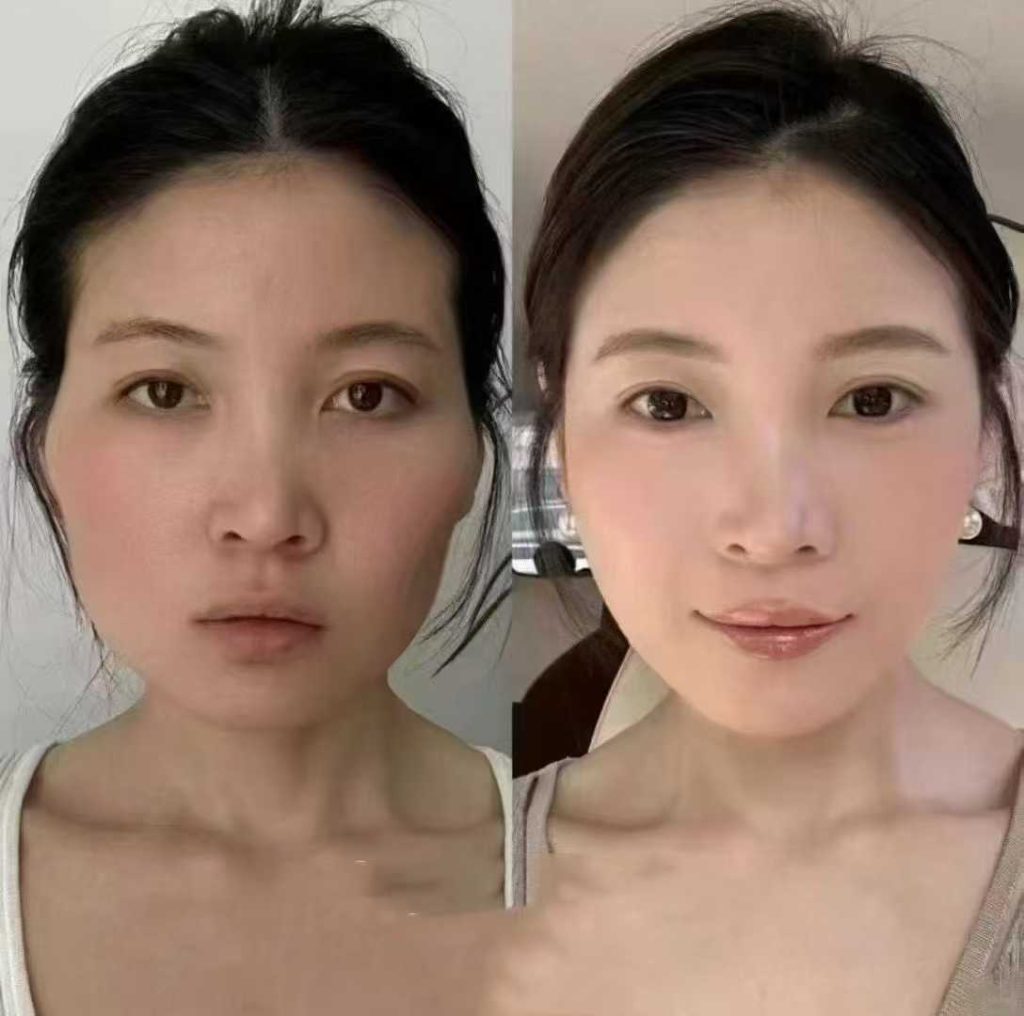 不用去算命去照镜子
脸就是命，脸好看心情好👉🏻心情好做啥都顺赶紧收拾收拾心情吧
​不开刀不手术轻松解决！-朋友圈文案论坛-朋友圈文案-云上韵美